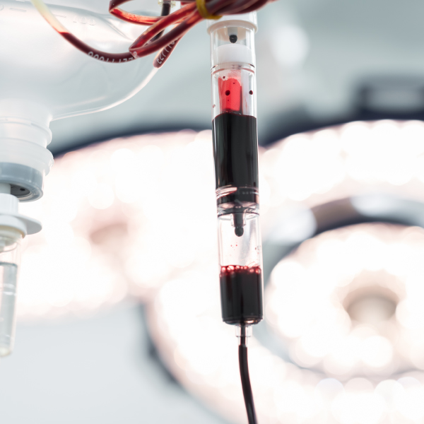 HPC for bone marrow treatments